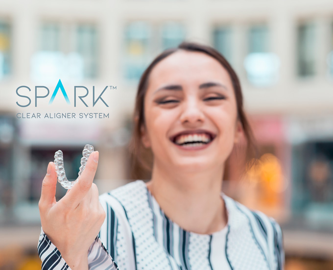  SPARK® clear aligners