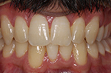 After