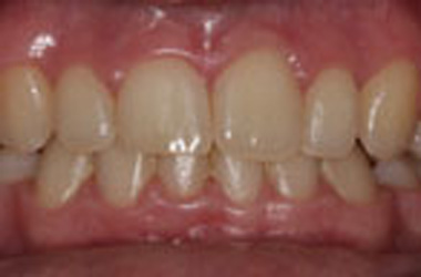 Before